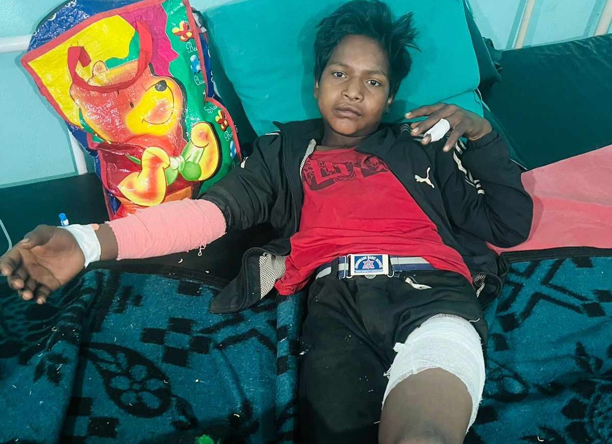 जंगली बदेलको आक्रमणबाट सल्यानमा बालक घाइते 