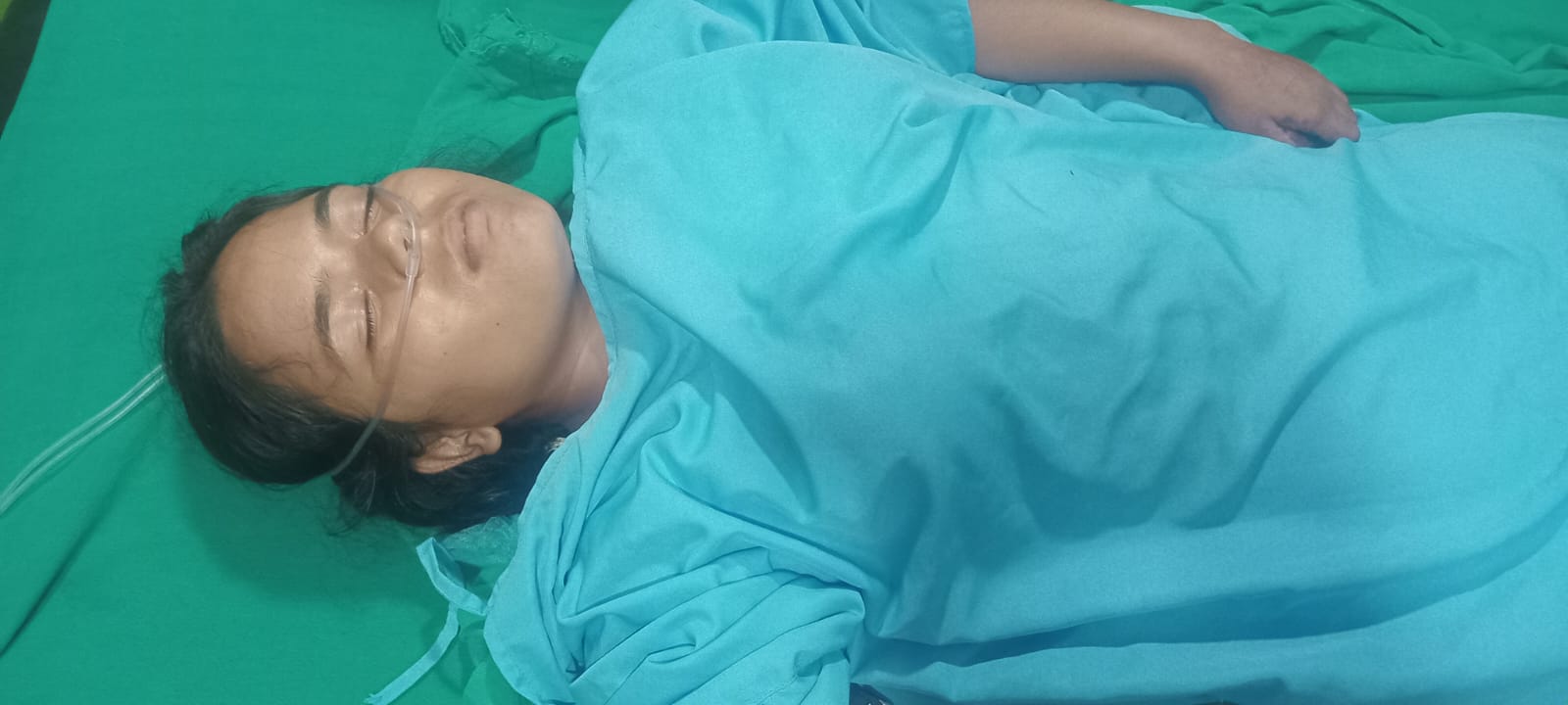 सल्यानमा बदेलको आक्रमणबाट बालिका घाइते