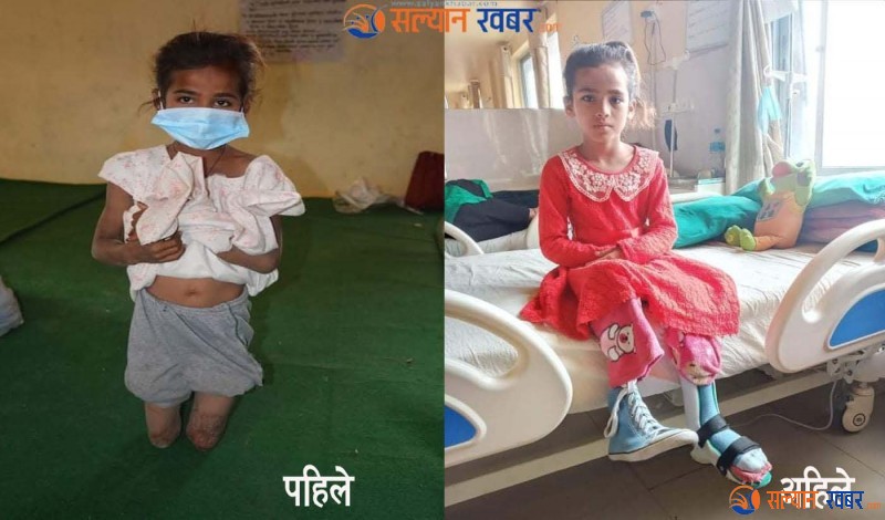 टिकाले पाइन ८ वर्षमा नयाँ जीवन 